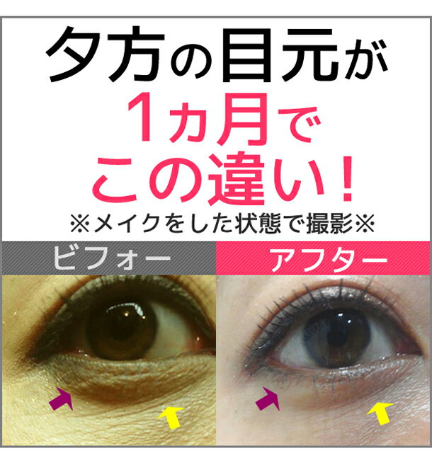 しわ取り/クリーム/目元/しわ/アイクリーム/目の下のたるみ